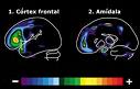 Atividade cerebral 